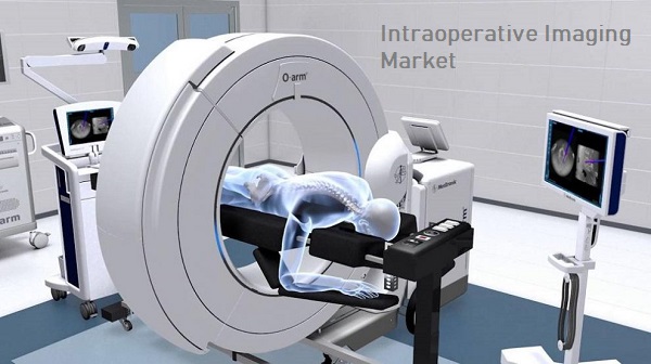 Intraoperative Imaging Market